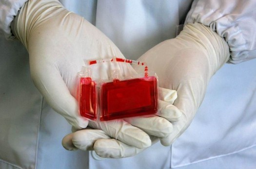ذخیره‌سازی ۳۰۰ نمونه خون بند ناف در خراسان‌جنوبی