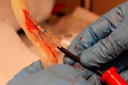 ذخیره‌سازی 500 نمونه خون بند ناف در خراسان‌جنوبی